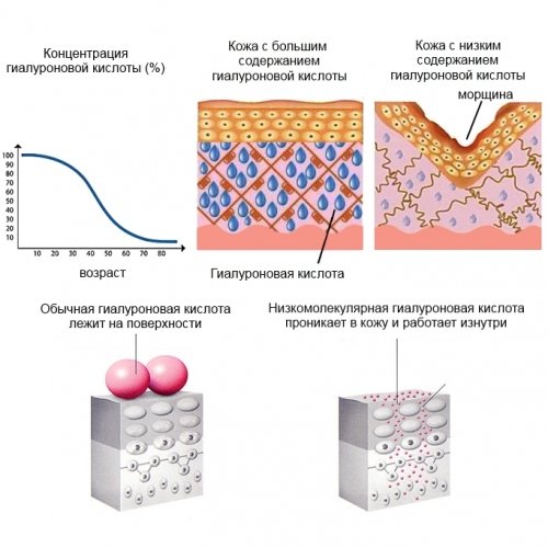 Коллаген с гиалуроновой кислотой. Недостаток гиалуроновой кислоты - для кожи лица и тела, проявление морщина. Как использовать, как принимать, Отзывы, подробное описание. 2